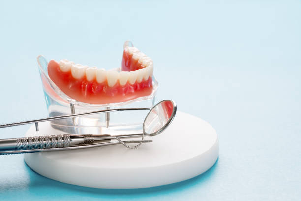 Dental Inlays and Onlays in Healdsburg, CA
